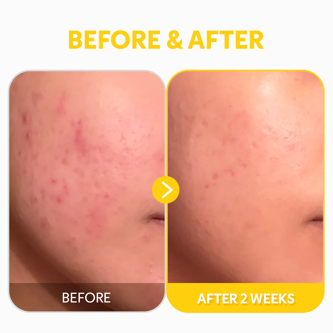 Pure Vitamin C24 Serum - Image 8